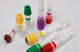 Blood Test Tubes Disposable Glass or Plastic Vacuum Blood Sample Collection Tube